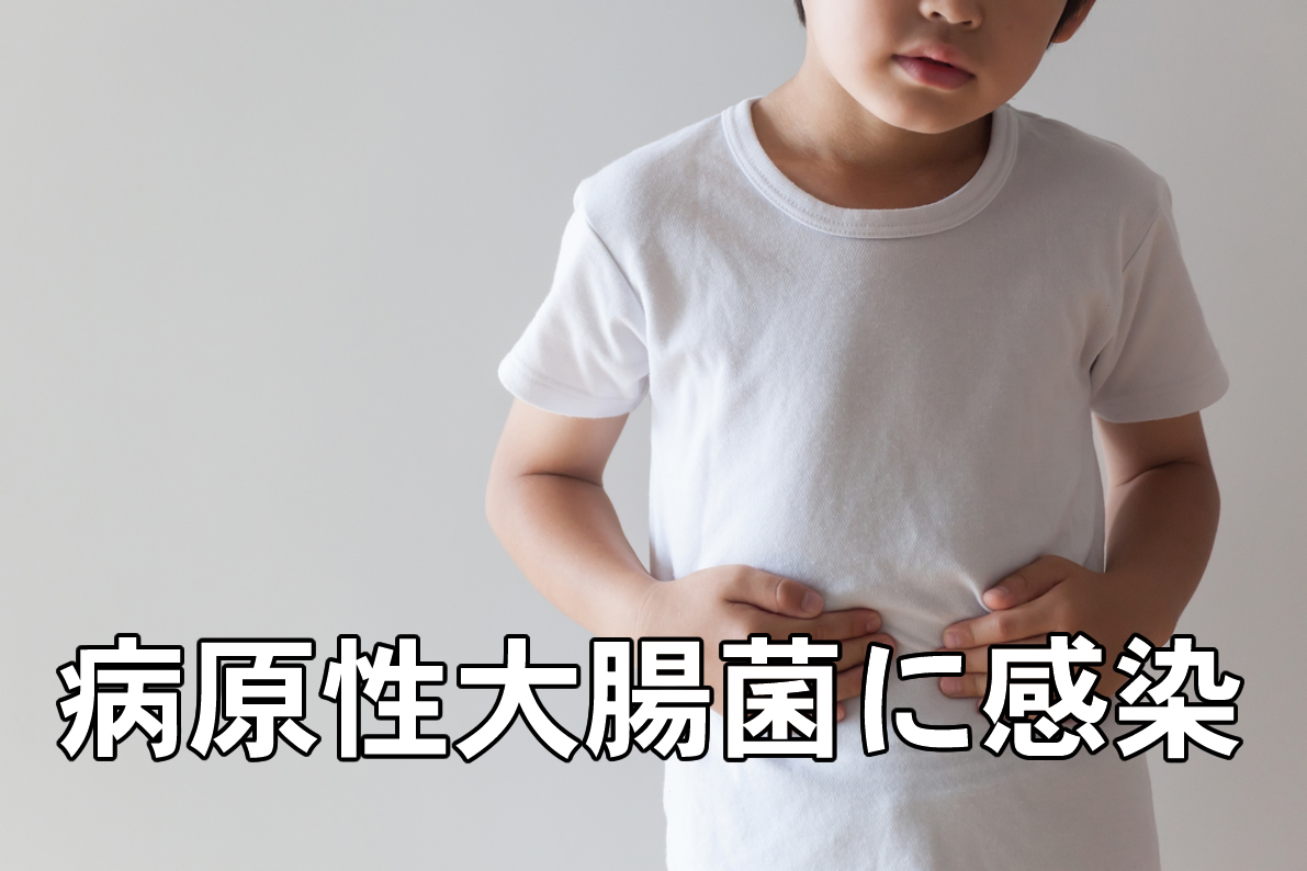 病原性大腸炎に感染